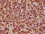 IHC image of CAC12265 diluted at 1:61.9 and staining in paraffin-embedded human pancreatic tissue performed on a Leica BondTM system. After dewaxing and hydration, antigen retrieval was mediated by high pressure in a citrate buffer (pH 6.0). Section was blocked with 10% normal goat serum 30min at RT. Then primary antibody (1% BSA) was incubated at 4? overnight. The primary is detected by a biotinylated secondary antibody and visualized using an HRP conjugated SP system.