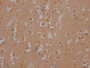 IHC image of CAC12266 diluted at 1:100 and staining in paraffin-embedded human brain tissue performed on a Leica BondTM system. After dewaxing and hydration, antigen retrieval was mediated by high pressure in a citrate buffer (pH 6.0). Section was blocked with 10% normal goat serum 30min at RT. Then primary antibody (1% BSA) was incubated at 4? overnight. The primary is detected by a Goat anti-rabbit IgG polymer labeled by HRP and visualized using 0.05% DAB.