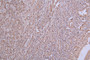 IHC image of CAC12283 diluted at 1:50 and staining in paraffin-embedded human lung tissue performed on a Leica BondTM system. After dewaxing and hydration, antigen retrieval was mediated by high pressure in a citrate buffer (pH 6.0). Section was blocked with 10% normal goat serum 30min at RT. Then primary antibody (1% BSA) was incubated at 4°C overnight. The primary is detected by a Goat anti-rabbit polymer IgG labeled by HRP and visualized using 0.24% DAB.