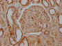 IHC image of CAC12287 diluted at 1:100 and staining in paraffin-embedded human kidney tissue performed on a Leica BondTM system. After dewaxing and hydration, antigen retrieval was mediated by high pressure in a citrate buffer (pH 6.0). Section was blocked with 10% normal goat serum 30min at RT. Then primary antibody (1% BSA) was incubated at 4? overnight. The primary is detected by a Goat anti-rabbit IgG polymer labeled by HRP and visualized using 0.05% DAB.