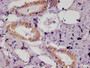 IHC image of CAC12291 diluted at 1:100 and staining in paraffin-embedded human salivary gland tissue performed on a Leica BondTM system. After dewaxing and hydration, antigen retrieval was mediated by high pressure in a citrate buffer (pH 6.0). Section was blocked with 10% normal goat serum 30min at RT. Then primary antibody (1% BSA) was incubated at 4°C overnight. The primary is detected by a Goat anti-rabbit polymer IgG labeled by HRP and visualized using 0.05% DAB.