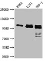 Western Blot; Positive WB detected in: K562 whole cell lysate, U-251 whole cell lysate, THP-1 whole cell lysate; All lanes: ITCH antibody at 1:1000; Secondary; Goat polyclonal to rabbit IgG at 1/50000 dilution; Predicted band size: 103, 99, 87 kDa; Observed band size: 103 kDa