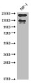 Western Blot; Positive WB detected in: THP-1 whole cell lysate; All lanes: ITGAL antibody at 1:2000; Secondary; Goat polyclonal to rabbit IgG at 1/50000 dilution; Predicted band size: 129, 135, 120 kDa; Observed band size: 130 kDa