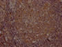 IHC image of CAC12298 diluted at 1:100 and staining in paraffin-embedded human lymph node tissue performed on a Leica BondTM system. After dewaxing and hydration, antigen retrieval was mediated by high pressure in a citrate buffer (pH 6.0). Section was blocked with 10% normal goat serum 30min at RT. Then primary antibody (1% BSA) was incubated at 4? overnight. The primary is detected by a Goat anti-rabbit IgG polymer labeled by HRP and visualized using 0.05% DAB.