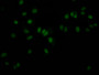 Immunofluorescence staining of MCF7 Cells with CAC12302 at 1:50, counter-stained with DAPI. The cells were fixed in 4% formaldehyde, permeated by 0.2% TritonX-100, and blocked in 10% normal Goat Serum. The cells were then incubated with the antibody overnight at 4?. Nuclear DNA was labeled in blue with DAPI. The secondary antibody was FITC-conjugated AffiniPure Goat Anti-Rabbit IgG (H+L).