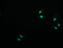 Immunofluorescence staining of HepG2 cell with CAC12303 at 1:50, counter-stained with DAPI. The cells were fixed in 4% formaldehyde and blocked in 10% normal Goat Serum. The cells were then incubated with the antibody overnight at 4°C. The secondary antibody was Alexa Fluor 587-congugated AffiniPure Goat Anti-Rabbit IgG(H+L).