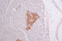 IHC image of CAC12312 diluted at 1:50 and staining in paraffin-embedded human pancreati tissue performed on a Leica BondTM system. After dewaxing and hydration, antigen retrieval was mediated by high pressure in a citrate buffer (pH 6.0). Section was blocked with 10% normal goat serum 30min at RT. Then primary antibody (1% BSA) was incubated at 4°C overnight. The primary is detected by a Goat anti-rabbit polymer IgG labeled by HRP and visualized using 0.34% DAB.