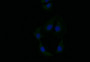 Immunofluorescence staining of A549 with CAC12314 at 1:10, counter-stained with DAPI. The cells were fixed in 4% formaldehyde and blocked in 10% normal Goat Serum. The cells were then incubated with the antibody overnight at 4°C. The secondary antibody was Alexa Fluor 519-congugated AffiniPure Goat Anti-Rabbit IgG(H+L).