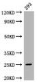 Western Blot; Positive WB detected in: 293 whole cell lysate; All lanes: Mad2L2 antibody at 1:2000; Secondary; Goat polyclonal to rabbit IgG at 1/50000 dilution; Predicted band size: 25 kDa; Observed band size: 25 kDa