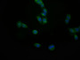 Immunofluorescence staining of PC-3 cell with CAC12341 at 1:50, counter-stained with DAPI. The cells were fixed in 4% formaldehyde and blocked in 10% normal Goat Serum. The cells were then incubated with the antibody overnight at 4°C. The secondary antibody was Alexa Fluor 553-congugated AffiniPure Goat Anti-Rabbit IgG(H+L).