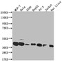 Western Blot; Positive WB detected in: MCF-7 whole cell lysate, Hela whole cell lysate, A549 whole cell lysate, HepG2 whole cell lysate, PC-3 whole cell lysate, Jurkat whole cell lysate, Rat liver tissue; All lanes: MAS1L antibody at 1:1000; Secondary; Goat polyclonal to rabbit IgG at 1/50000 dilution; Predicted band size: 43 kDa; Observed band size: 36-50 kDa
