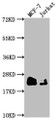 Western Blot; Positive WB detected in: MCF-7 whole cell lysate, Jurkat whole cell lysate; All lanes: MGMT antibody at 1:1500; Secondary; Goat polyclonal to rabbit IgG at 1/50000 dilution; Predicted band size: 22 kDa; Observed band size: 22 kDa
