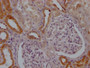 IHC image of CAC12362 diluted at 1:100 and staining in paraffin-embedded human kidney tissue performed on a Leica BondTM system. After dewaxing and hydration, antigen retrieval was mediated by high pressure in a citrate buffer (pH 6.0). Section was blocked with 10% normal goat serum 30min at RT. Then primary antibody (1% BSA) was incubated at 4? overnight. The primary is detected by a Goat anti-rabbit IgG polymer labeled by HRP and visualized using 0.05% DAB.