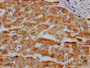 IHC image of CAC12366 diluted at 1:100 and staining in paraffin-embedded human liver tissue performed on a Leica BondTM system. After dewaxing and hydration, antigen retrieval was mediated by high pressure in a citrate buffer (pH 6.0). Section was blocked with 10% normal goat serum 30min at RT. Then primary antibody (1% BSA) was incubated at 4? overnight. The primary is detected by a Goat anti-rabbit IgG polymer labeled by HRP and visualized using 0.05% DAB.