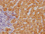 IHC image of CAC12367 diluted at 1:100 and staining in paraffin-embedded human liver tissue performed on a Leica BondTM system. After dewaxing and hydration, antigen retrieval was mediated by high pressure in a citrate buffer (pH 6.0). Section was blocked with 10% normal goat serum 30min at RT. Then primary antibody (1% BSA) was incubated at 4? overnight. The primary is detected by a Goat anti-rabbit IgG polymer labeled by HRP and visualized using 0.05% DAB.