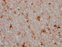 IHC image of CAC12367 diluted at 1:100 and staining in paraffin-embedded human brain tissue performed on a Leica BondTM system. After dewaxing and hydration, antigen retrieval was mediated by high pressure in a citrate buffer (pH 6.0). Section was blocked with 10% normal goat serum 30min at RT. Then primary antibody (1% BSA) was incubated at 4? overnight. The primary is detected by a Goat anti-rabbit IgG polymer labeled by HRP and visualized using 0.05% DAB.