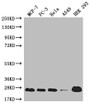 Western Blot; Positive WB detected in: MCF-7 whole cell lysate, PC3 whole cell lysate, Hela whole cell lysate, A549 whole cell lysate, HEK293 whole cell lysate; All lanes: MRAS antibody at 1:1000; Secondary; Goat polyclonal to rabbit IgG at 1/50000 dilution; Predicted band size: 24, 16 kDa; Observed band size: 24 kDa