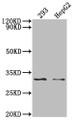 Western Blot; Positive WB detected in: 293 whole cell lysate, HepG2 whole cell lysate, ; All lanes: NDUFS3 antibody at 1:2000; Secondary; Goat polyclonal to rabbit IgG at 1/50000 dilution; Predicted band size: 31, 15 KDa; Observed band size: 31 kDa