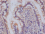 IHC image of CAC12383 diluted at 1:100 and staining in paraffin-embedded human small intestine tissue performed on a Leica BondTM system. After dewaxing and hydration, antigen retrieval was mediated by high pressure in a citrate buffer (pH 6.0). Section was blocked with 10% normal goat serum 30min at RT. Then primary antibody (1% BSA) was incubated at 4°C overnight. The primary is detected by a Goat anti-rabbit polymer IgG labeled by HRP and visualized using 0.05% DAB.