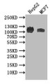 Western Blot; Positive WB detected in: HEPG2 whole cell lysate, MCF7 whole cell lysate; All lanes: ANPRB antibody at 1:1000; Secondary; Goat polyclonal to rabbit IgG at 1/50000 dilution; Predicted band size: 117 kDa; Observed band size: 117 kDa