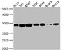 Western Blot; Positive WB detected in: Hela whole cell lysate, 293 whole cell lysate, K562 whole cell lysate, 293T whole cell lysate, A549 whole cell lysate, Rat Brain whole cell lysate, Mouse Brain whole cell lysate; All lanes: NUDC antibody at 1:1000; Secondary; Goat polyclonal to rabbit IgG at 1/50000 dilution; Predicted band size: 39 kDa; Observed band size: 45 kDa