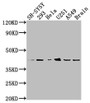 Western Blot; Positive WB detected in: SH-SY5Y whole cell lysate, 293 whole cell lysate, Hela whole cell lysate, U251 whole cell lysate, A549 whole cell lysate, Mouse brain tissue; All lanes: OPRD1 antibody at 1:2000; Secondary; Goat polyclonal to rabbit IgG at 1/50000 dilution; Predicted band size: 41 kDa; Observed band size: 41 kDa