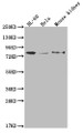 Western Blot; Positive WB detected in: HL-60 whole cell lysate, Hela whole cell lysate, Mouse kidney tissue; All lanes: OS9 antibody at 1:2000; Secondary; Goat polyclonal to rabbit IgG at 1/50000 dilution; Predicted band size: 76, 70, 68, 74, 66, 64, 70, 61 kDa; Observed band size: 72-95 kDa