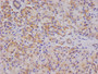 IHC image of CAC12405 diluted at 1:100 and staining in paraffin-embedded human pancreatic tissue performed on a Leica BondTM system. After dewaxing and hydration, antigen retrieval was mediated by high pressure in a citrate buffer (pH 6.0). Section was blocked with 10% normal goat serum 30min at RT. Then primary antibody (1% BSA) was incubated at 4°C overnight. The primary is detected by a Goat anti-rabbit polymer IgG labeled by HRP and visualized using 0.05% DAB.