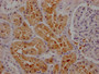 IHC image of CAC12406 diluted at 1:100 and staining in paraffin-embedded human kidney tissue performed on a Leica BondTM system. After dewaxing and hydration, antigen retrieval was mediated by high pressure in a citrate buffer (pH 6.0). Section was blocked with 10% normal goat serum 30min at RT. Then primary antibody (1% BSA) was incubated at 4? overnight. The primary is detected by a Goat anti-rabbit IgG polymer labeled by HRP and visualized using 0.05% DAB.