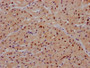 IHC image of CAC12407 diluted at 1:100 and staining in paraffin-embedded human heart tissue performed on a Leica BondTM system. After dewaxing and hydration, antigen retrieval was mediated by high pressure in a citrate buffer (pH 6.0). Section was blocked with 10% normal goat serum 30min at RT. Then primary antibody (1% BSA) was incubated at 4? overnight. The primary is detected by a Goat anti-rabbit IgG polymer labeled by HRP and visualized using 0.05% DAB.