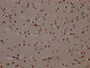 IHC image of CAC12407 diluted at 1:100 and staining in paraffin-embedded human brain tissue performed on a Leica BondTM system. After dewaxing and hydration, antigen retrieval was mediated by high pressure in a citrate buffer (pH 6.0). Section was blocked with 10% normal goat serum 30min at RT. Then primary antibody (1% BSA) was incubated at 4? overnight. The primary is detected by a Goat anti-rabbit IgG polymer labeled by HRP and visualized using 0.05% DAB.