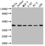 Western Blot; Positive WB detected in: Hela whole cell lysate, Jurkat whole cell lysate, MCF-7 whole cell lysate, U-87 whole cell lysate, PC-3 whole cell lysate, L02 whole cell lysate; All lanes: p38 antibody at 1:1000; Secondary; Goat polyclonal to rabbit IgG at 1/50000 dilution; Predicted band size: 42, 42, 35, 36, 30 kDa; Observed band size: 42 kDa