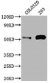 Western Blot; Positive WB detected in: COLO320 whole cell lysate, 293 whole cell lysate; All lanes: TP53 antibody at 1:2000; Secondary; Goat polyclonal to rabbit IgG at 1/50000 dilution; Predicted band size: 44, 38, 39, 40, 34, 35, 30, 24, 25 kDa; Observed band size: 53 kDa