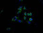 Immunofluorescence staining of HepG2 Cells with CAC12411 at 1:50, counter-stained with DAPI. The cells were fixed in 4% formaldehyde, permeated by 0.2% TritonX-100, and blocked in 10% normal Goat Serum. The cells were then incubated with the antibody overnight at 4?. Nuclear DNA was labeled in blue with DAPI. The secondary antibody was FITC-conjugated AffiniPure Goat Anti-Rabbit IgG (H+L).