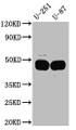 Western Blot; Positive WB detected in: U-251 whole cell lysate, U-87 whole cell lysate; All lanes: PAI1 Antibody at 1:1000; Secondary; Goat polyclonal to rabbit IgG at 1/50000 dilution; Predicted band size: 46, 44 kDa; Observed band size: 45 kDa