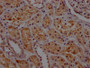 IHC image of CAC12416 diluted at 1:100 and staining in paraffin-embedded human kidney tissue performed on a Leica BondTM system. After dewaxing and hydration, antigen retrieval was mediated by high pressure in a citrate buffer (pH 6.0). Section was blocked with 10% normal goat serum 30min at RT. Then primary antibody (1% BSA) was incubated at 4? overnight. The primary is detected by a Goat anti-rabbit IgG polymer labeled by HRP and visualized using 0.05% DAB.