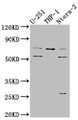 Western Blot; Positive WB detected in: U-251 whole cell lysate, THP-1 whole cell lysate, Ntera-2 whole cell lysate; All lanes: PTH1R antibody at 1:1000; Secondary; Goat polyclonal to rabbit IgG at 1/50000 dilution; Predicted band size: 67 kDa; Observed band size: 72, 55 kDa
