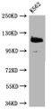 Western Blot; Positive WB detected in: K562 whole cell lysate; All lanes: PARP antibody at 1:2000; Secondary; Goat polyclonal to rabbit IgG at 1/50000 dilution; Predicted band size: 114 kDa; Observed band size: 114 kDa