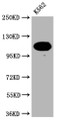 Western Blot; Positive WB detected in: K562 whole cell lysate; All lanes: PARP antibody at 1:2000; Secondary; Goat polyclonal to rabbit IgG at 1/50000 dilution; Predicted band size: 114 KDa; Observed band size: 114 kDa