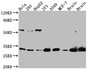 Western Blot; Positive WB detected in: Hela whole cell lysate, 293 whole cell lysate, HepG2 whole cell lysate, NIH/3T3 whole cell lysate, A549 whole cell lysate, MCF-7 whole cell lysate, Mouse Brain whole cell lysate, Rat Brain whole cell lysate; All lanes: PGAM1 Antibody at 1:1000; Secondary; Goat polyclonal to rabbit IgG at 1/50000 dilution; Predicted band size: 28 kDa; Observed band size: 29 kDa