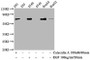 Western Blot; Positive WB detected in 293 whole cell lysate,A549 whole cell lysate,HepG2 whole cell lysate(treated with Calyculin A or EGF); All lanes Phospho-ATF2 antibody at 1.015ug/ml; Secondary; Goat polyclonal to rabbit IgG at 1/50000 dilution; Predicted band size: 70 KDa; Observed band size: 70 KDa