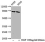 Western Blot; Positive WB detected in A549 whole cell lysate(treated with EGF or not); All lanes Phospho-BRAF antibody at 1.3ug/ml; Secondary; Goat polyclonal to rabbit IgG at 1/50000 dilution; Predicted band size: 85 KDa; Observed band size: 85 KDa