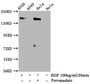 Western Blot; Positive WB detected in A549 whole cell lysate,Hela whole cell lysate(treated with Pervanadate or EGF); All lanes Phospho-EGFR antibody at 1.35ug/ml; Secondary; Goat polyclonal to rabbit IgG at 1/50000 dilution; Predicted band size: 170 KDa; Observed band size: 170 KDa