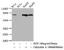 Western Blot; Positive WB detected in Hela whole cell lysate,HepG2 whole cell lysate(treated with Calyculin A or EGF); All lanes Phospho-GYS1 antibody at 1.12ug/ml; Secondary; Goat polyclonal to rabbit IgG at 1/50000 dilution; Predicted band size: 85 KDa; Observed band size: 85 KDa