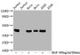 Western Blot; Positive WB detected in Jurkat whole cell lysate ela whole cell lysate 549 whole cell lysate(treated with EGF or not); All lanes Phospho-MAPK3 antibody at 0.95ug/ml; Secondary; Goat polyclonal to rabbit IgG at 1/50000 dilution; Predicted band size: 42 KDa; Observed band size: 42 KDa