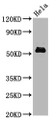 Western Blot; Positive WB detected in Hela whole cell lysate; All lanes Phospho-MYC antibody at 1.4ug/ml; Secondary; Goat polyclonal to rabbit IgG at 1/50000 dilution; Predicted band size: 57 KDa; Observed band size: 57 KDa