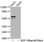 Western Blot; Positive WB detected in HepG2 whole cell lysate(treated with EGF or not); All lanes Phospho-MYC antibody at 0.99ug/ml; Secondary; Goat polyclonal to rabbit IgG at 1/50000 dilution; Predicted band size: 57 KDa; Observed band size: 57 KDa