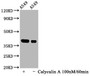 Western Blot; Positive WB detected in A549 whole cell lysate(treated with Calyculin A or not); All lanes Phospho-NFKBIA antibody at 1.07ug/ml; Secondary; Goat polyclonal to rabbit IgG at 1/50000 dilution; Predicted band size: 39 KDa; Observed band size: 39 KDa