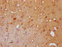 IHC image of CAC12470 diluted at 1:100 and staining in paraffin-embedded rat brain tissue performed on a Leica BondTM system. After dewaxing and hydration, antigen retrieval was mediated by high pressure in a citrate buffer (pH 6.0). Section was blocked with 10% normal goat serum 30min at RT. Then primary antibody (1% BSA) was incubated at 4? overnight. The primary is detected by a biotinylated secondary antibody and visualized using an HRP conjugated SP system.