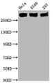 Western Blot; Positive WB detected in Hela whole cell lysate,A549 whole cell lysate,293 whole cell lysate; All lanes Phospho-POLR2A antibody at 0.75ug/ml; Secondary; Goat polyclonal to rabbit IgG at 1/50000 dilution; Predicted band size: 270 KDa; Observed band size: 270 KDa